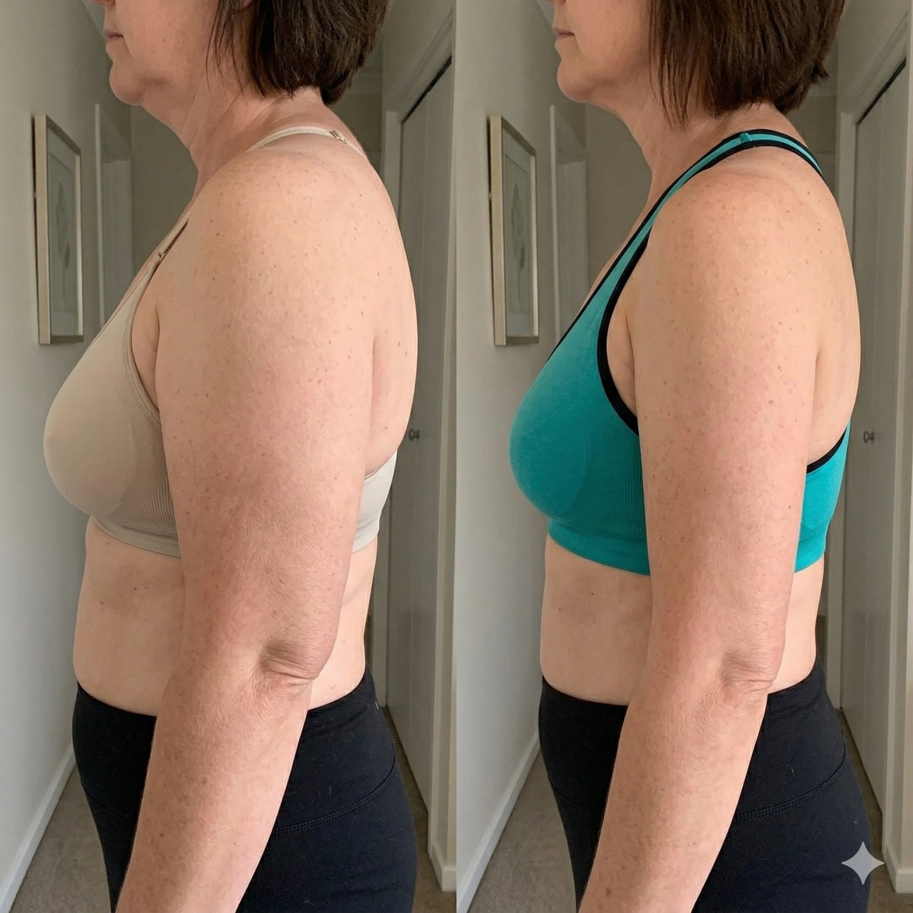 Before and after arm comparison